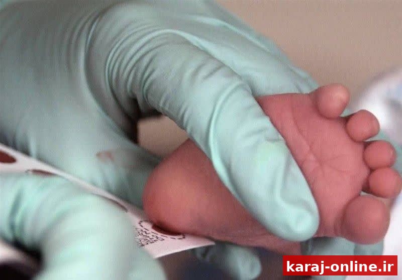 نجات نوزادان البرزی از عوارض تیروئید؛ دستاوردهای شاخص استان در تشخیص زودهنگام