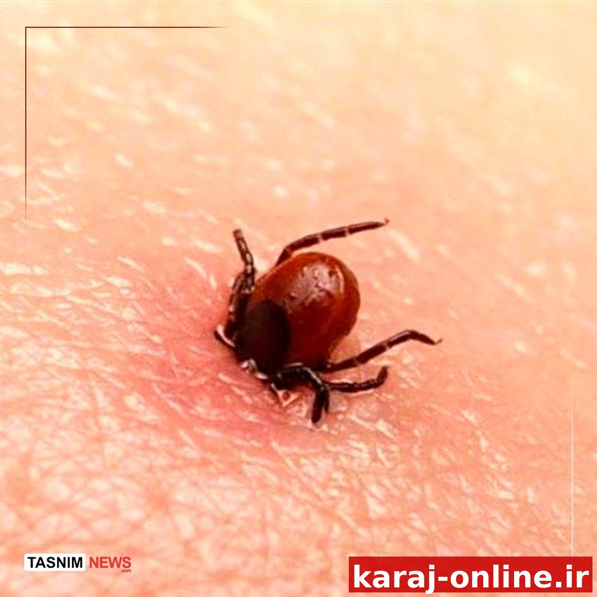 مرگ ۵ نفر بر اثر تب کریمه کنگو در کشور