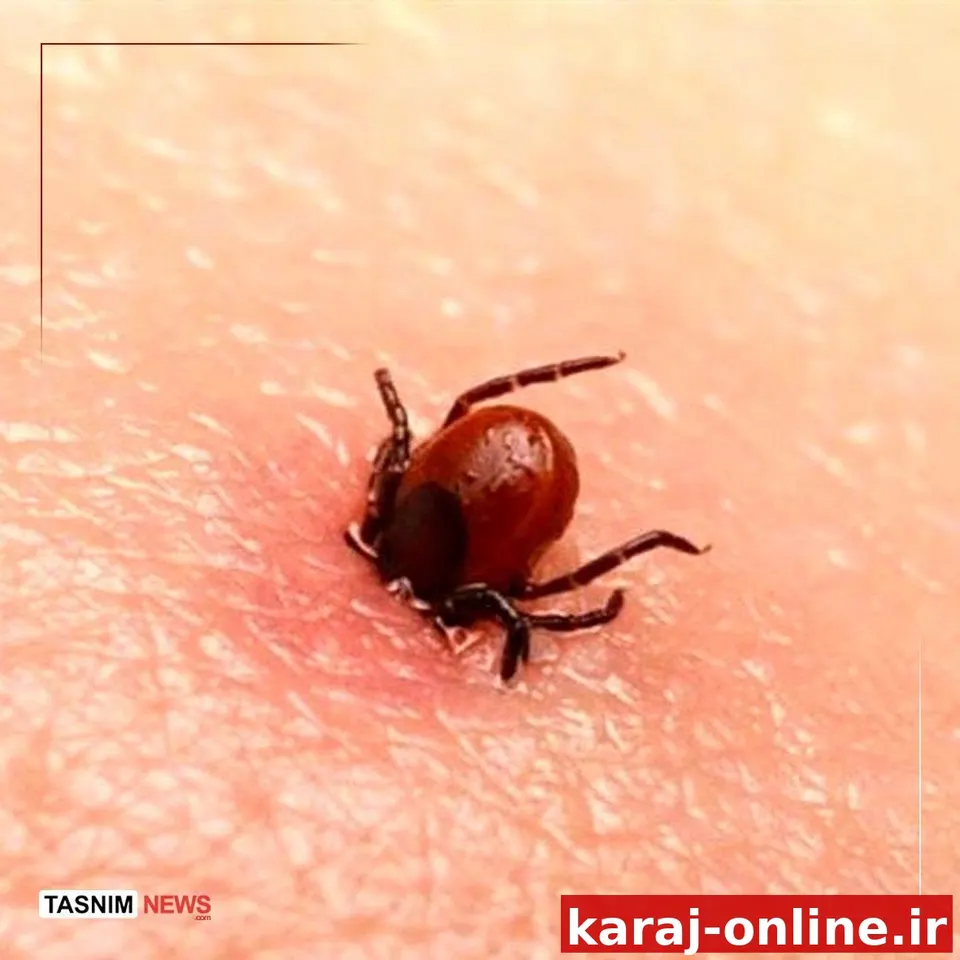 مرگ ۵ نفر بر اثر تب کریمه کنگو در کشور