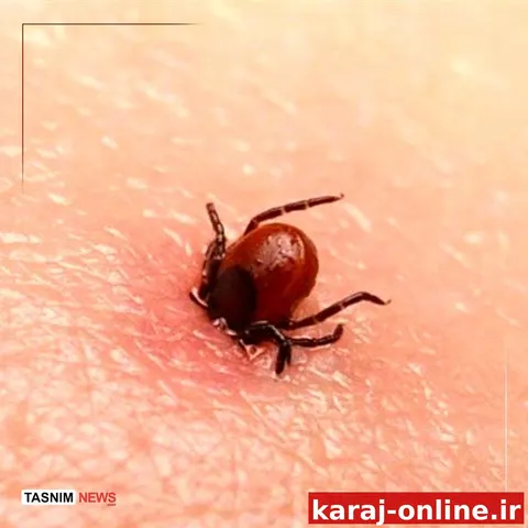 مرگ ۵ نفر بر اثر تب کریمه کنگو در کشور