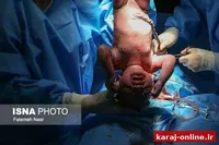 افزایش سزارین و کاهش زایمان طبیعی در البرز